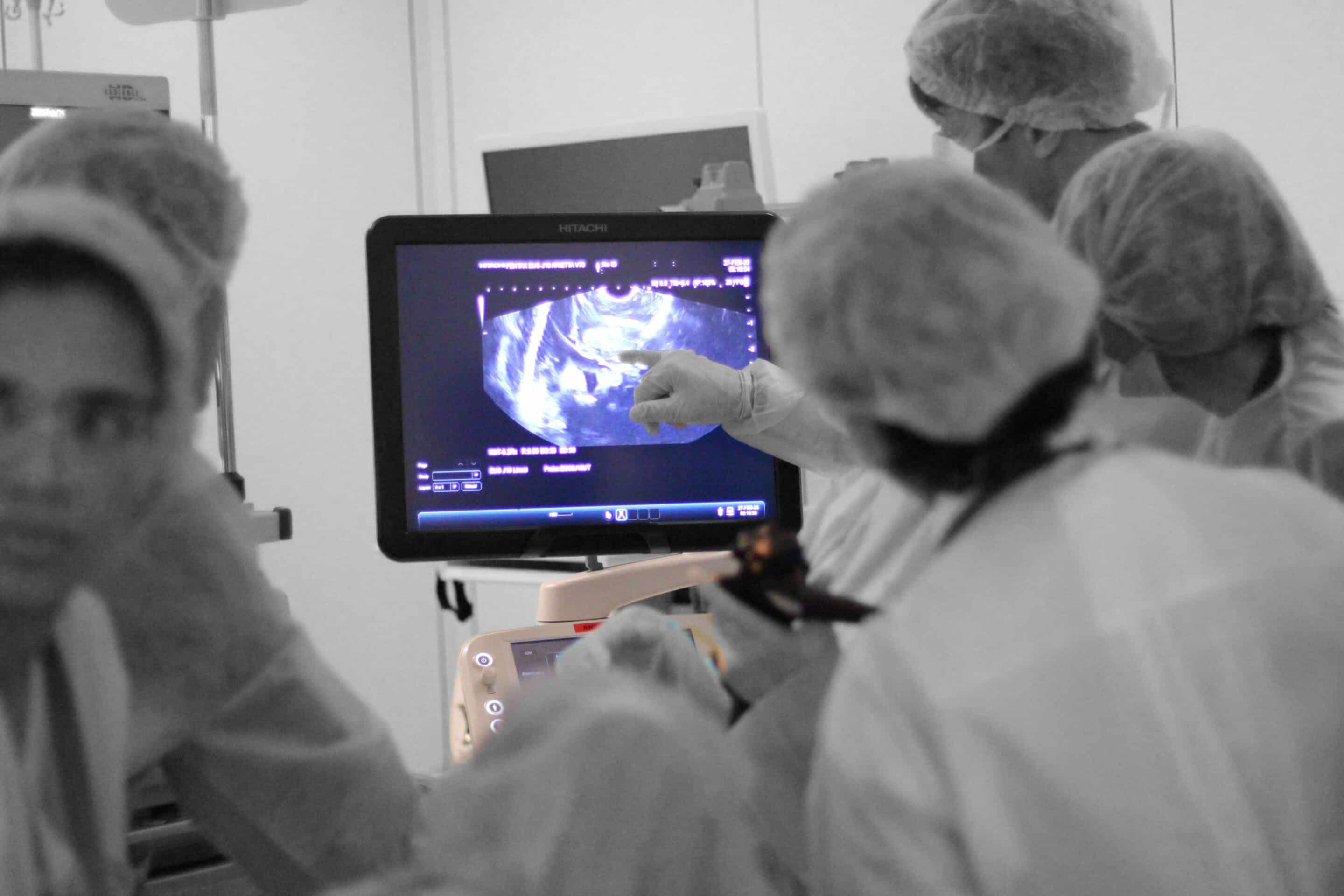 ITEC - International Therapeutic Endoscopic Ultrasound (TEUS) – Image 3