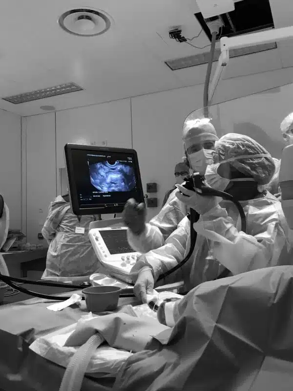 ITEC - International Therapeutic Endoscopic Ultrasound (TEUS) - Image 4