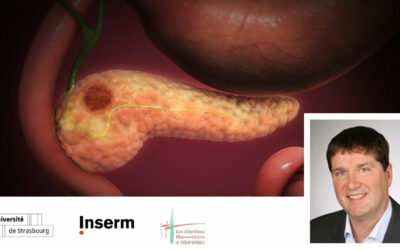 Le cancer du pancréas : le Pr. Thomas Baumert lauréat d’un prestigieux ERC Proof of Concept Grant