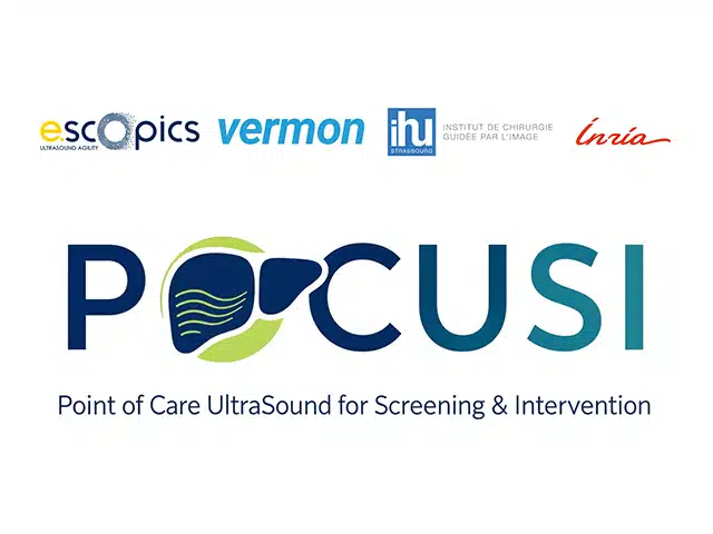 Communiqué de presse : Une nouvelle génération d’échographes logiciels, intelligents et frugaux  E-Scopics, Vermon, l’IHU de Strasbourg et Inria se réunissent autour du consortium stratégique POCUSI
