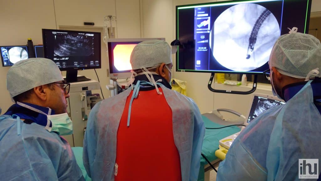 Atelier pratique de simulation lors du cours d'écho-endoscopie thérapeutique ITEC-IHU à Strasbourg