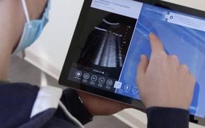 ENSIST Project: InSimo and the IHU Strasbourg launch an Echoendoscopy Module on diSplay U/S