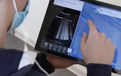 Projet ENSIST : InSimo et l’IHU Strasbourg lancent un module d’écho-endoscopie sur diSplay U/S