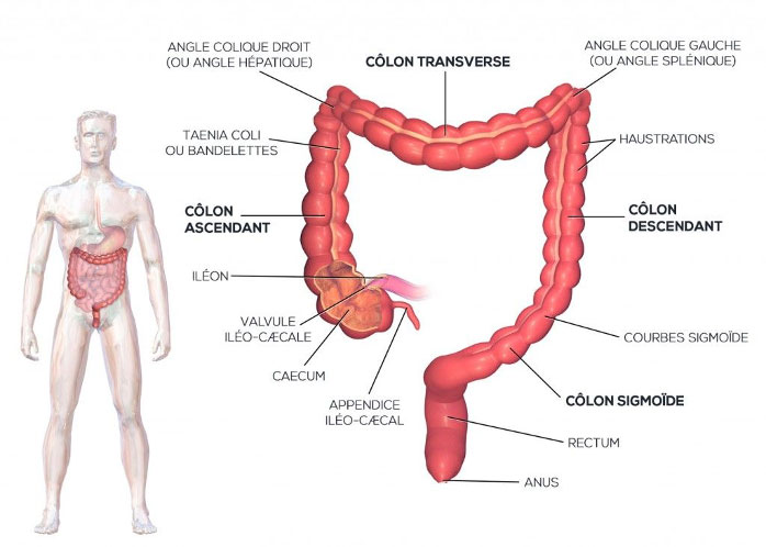 cancer colon gauche)