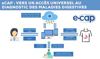 eCAP : vers un accès universel au diagnostic des maladies digestives